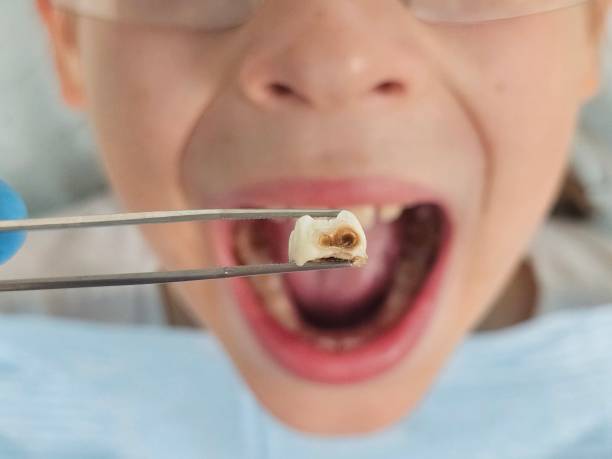Best Knocked-Out Tooth Emergency  in Brackenridge, PA